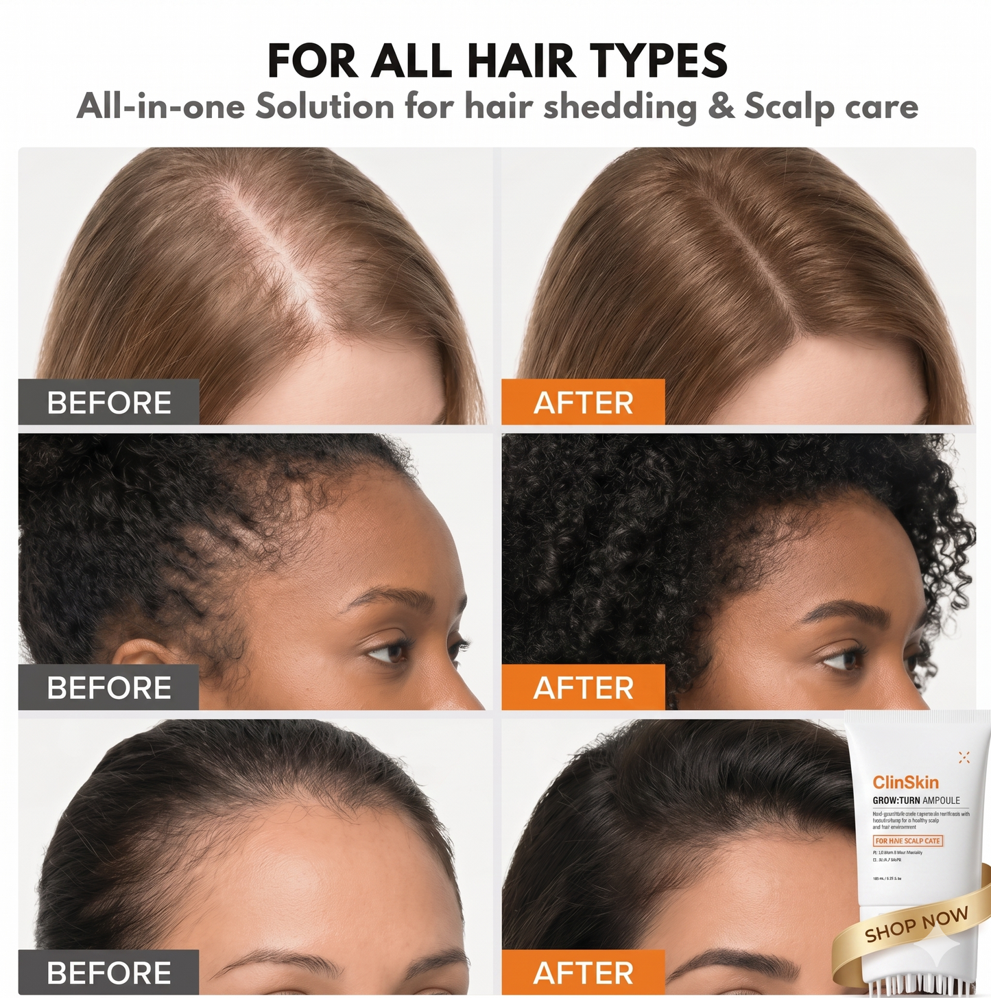 ClinSkin Korean Hair Growth Serum