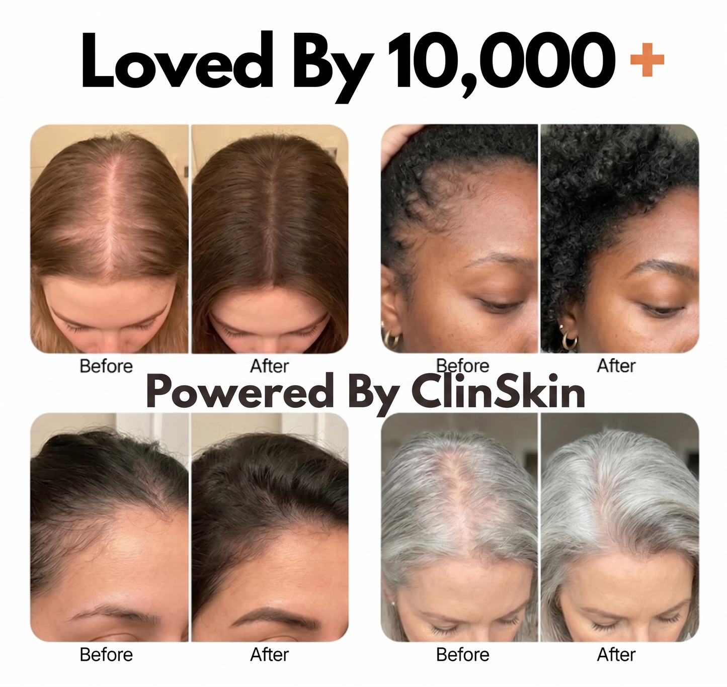 ClinSkin Korean Hair Growth Serum
