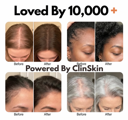 ClinSkin Korean Hair Growth Serum
