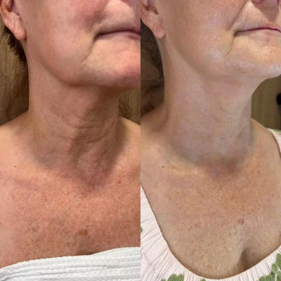 Susan L, 47