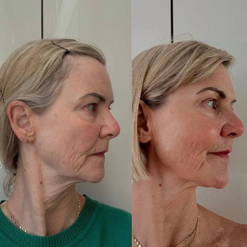 Barbara M, 55